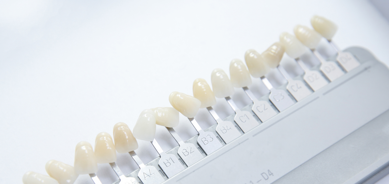 ホワイトニングとは 白く美しい歯に導く