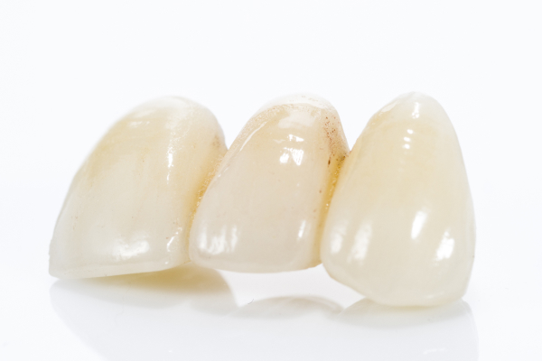 審美歯科の方針決定