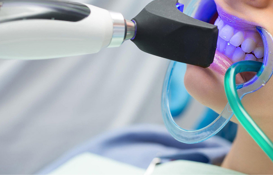 オフィスホワイトニング