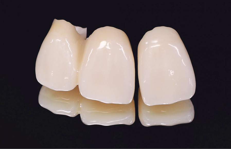 E-MAX（マルチレイヤー）